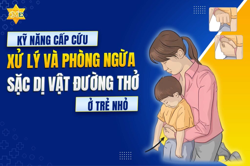 Khóa học kỹ năng cấp cứu, xử lý và phòng ngừa sặc dị vật đường thở ở trẻ nhỏ